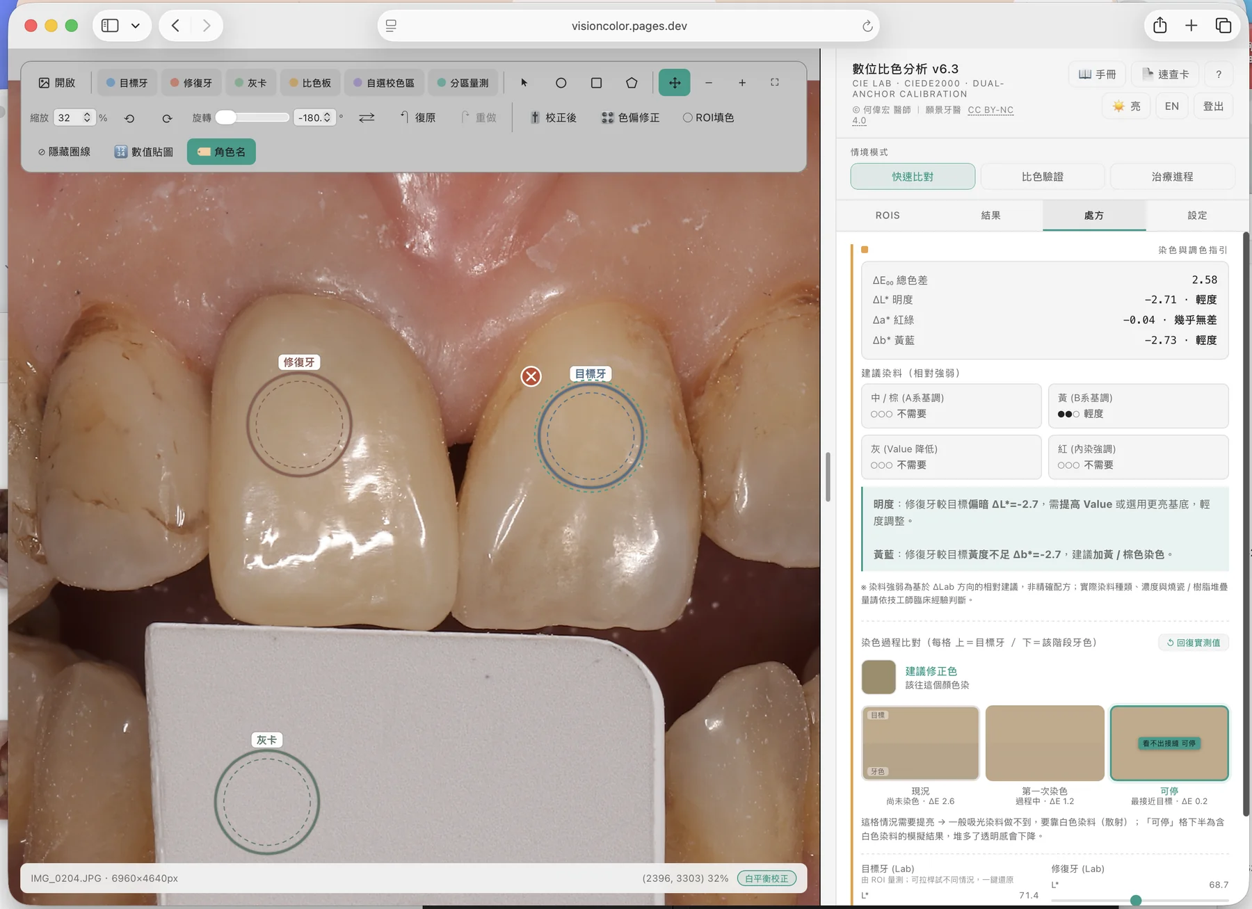 Tablet — shade analysis and staining guidance